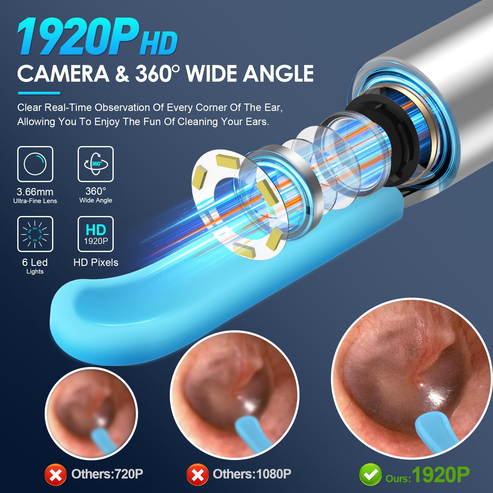 Jupiter Smart Visual Ear Cleaner
